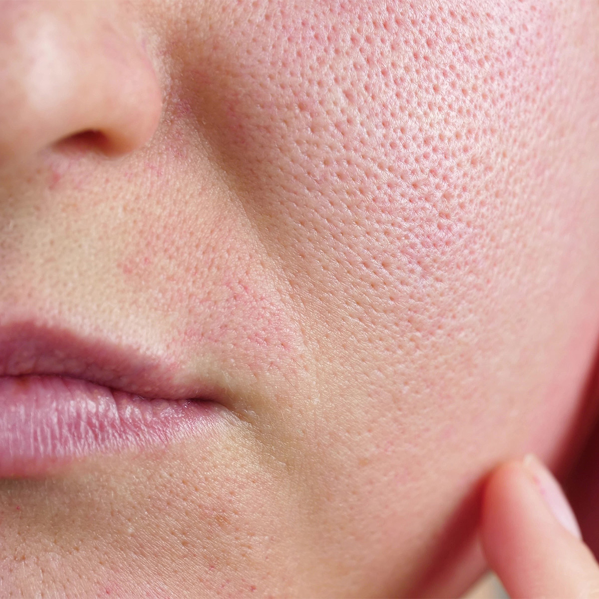 Vertical pore close-up